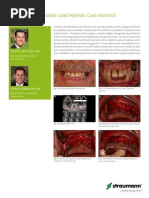 Double Jaw Immediate Load Hybrids: Case Abstract: Scott E. Keith, DDS, Ms