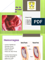 Hemorragia Segunda Mitad Del Embarazo