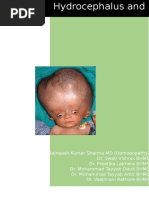 Hydrocephalus and Homoeopathy