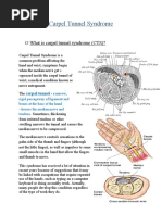 Carpel Tunnel Syndrome (CTS)