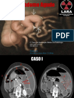 Abdome Agudo I (Obstrução Do Delgado)
