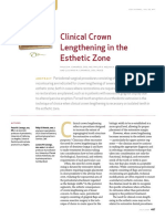 Clinical Crown Lengthening in The Esthetic Zone2028