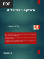 Artritis Septica Infantil