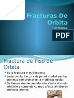 Fracturas de Orbita