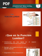 Puncion Lumbar