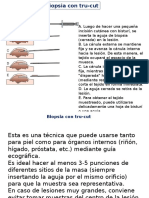 Biopsia