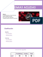 Leucemia Aguda