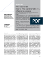 Verticalización de Molares PDF