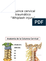 Esguince Cervical