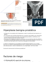 Prostata