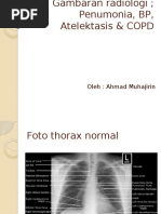 Gambaran Radiologi Thorax