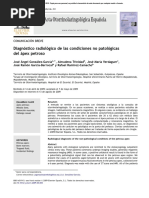 Diagnostico Radiologico de Las Condiciones No Patologicas Del Apex Petroso