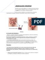 Obstrucción Intestinal