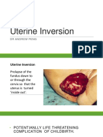 Uterine Inversion1