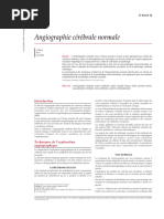 Angiographie Cérébrale Normale