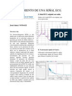 PROCESAMIENTO DE UNA SEÑAL ECG (Tarea 2) PDF