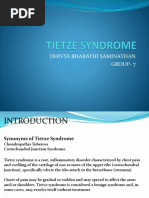 Tietze Syndrome