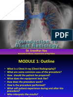 Fundamentals of Chest Radiology