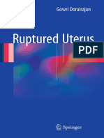 Ruptured Uterus