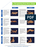 2 Months: Recognizing Early Motor Delays: A Comparison Examination of 2 Month Old Infants