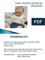 Brachial Plexus Injury