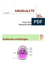 Amigdalite