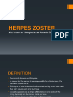 Herpes Zoster