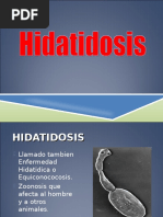 Hidatidosis