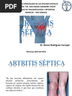 Artritis Septica