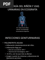 Patologia Del Riñon y Vias Urinarias en Ecografia