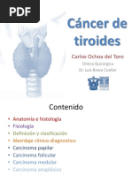 R) - Cáncer de Tiroides