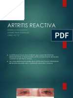 Artritis Reactiva