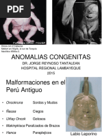 Anomalías Congenitas