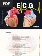 ECG de Velez