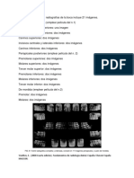 Técnica Radiográfica: Paralelismo y Bisectriz