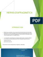 Hernia Diafragmatica