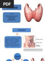 Tiroides