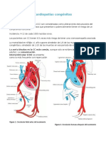 Cardiopatías Congénitas