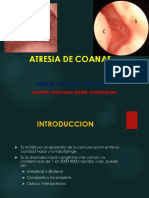 Atresia Coanas