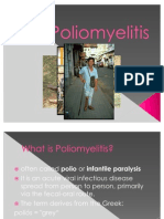 Poliomyelitis