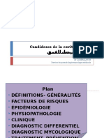 Candidoses de La Cavité Buccale