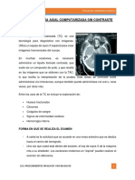 La Tomografía Axial Computarizada