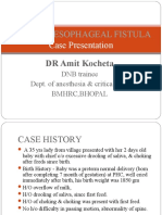 Tracheoesophageal Fistula: Case Presentation