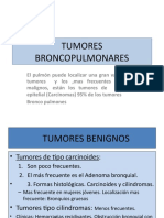 Tumores Broncopulmonares