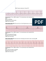 Cardiac Rhythms