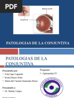 Patologias de La Conjuntiva