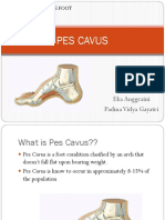 Pes Cavus: Eka Anggraini Padma Vidya Gayatri