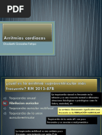 Arritmias Preguntas