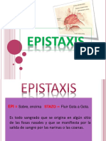 Epistaxis