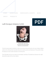 Left Occiput Anterior (LOA)